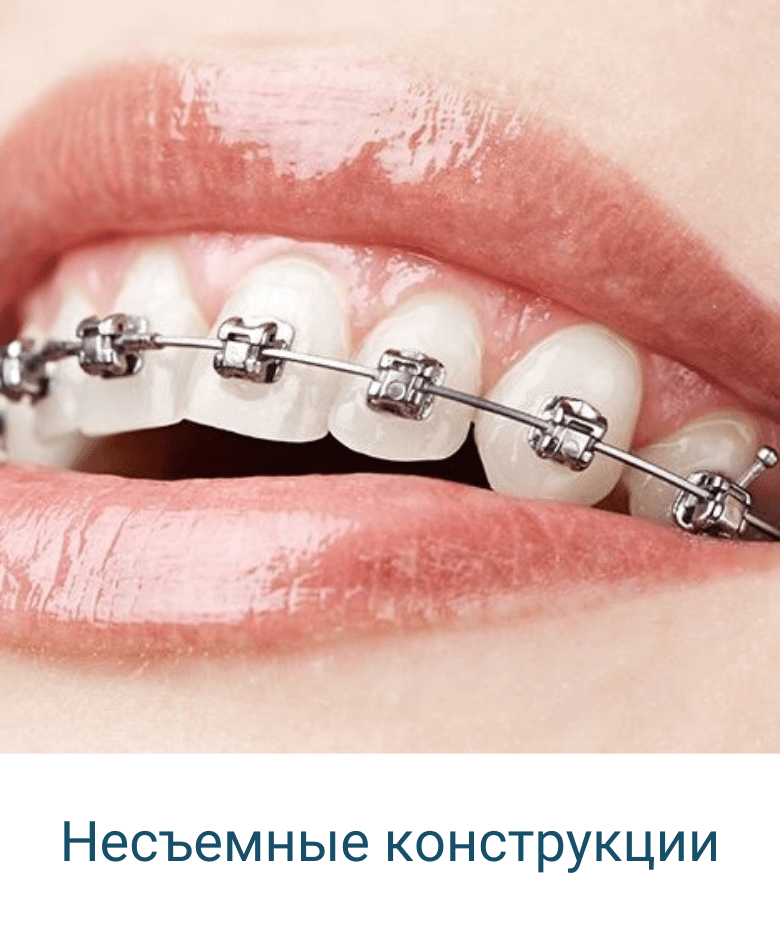 ортодонт бельцы 3 (1)